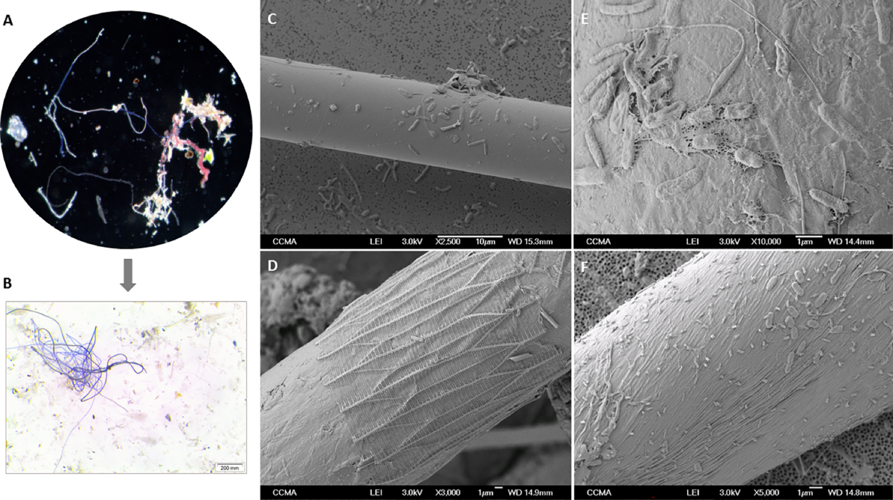 microscopy photos of microfibers, revealing tiny bacteria and microbes on the surface