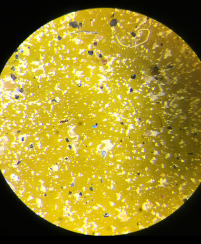 Green-yellow specks visible in a circular microscopic view with some small colored specks